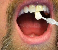 The image shows a close-up of an adult male with a beard brushing his teeth, focusing on his open mouth with a toothbrush near the teeth.