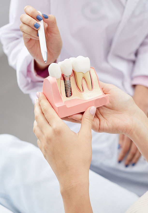 A dental professional is demonstrating a dental implant placement process with a model mouth and a handheld drill.