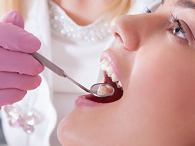 A woman receiving dental care, with a dental professional using a drill on her teeth.