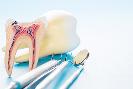 An illustration of a tooth with an exposed pulp chamber, accompanied by dental instruments such as a scaler and a mirror, all set against a blue background.