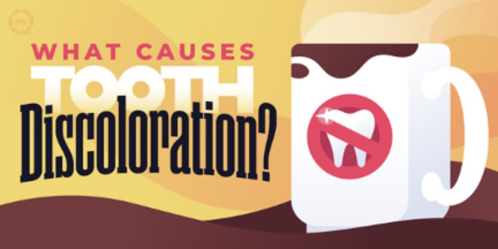 What-Causes-Tooth-Discoloration-01